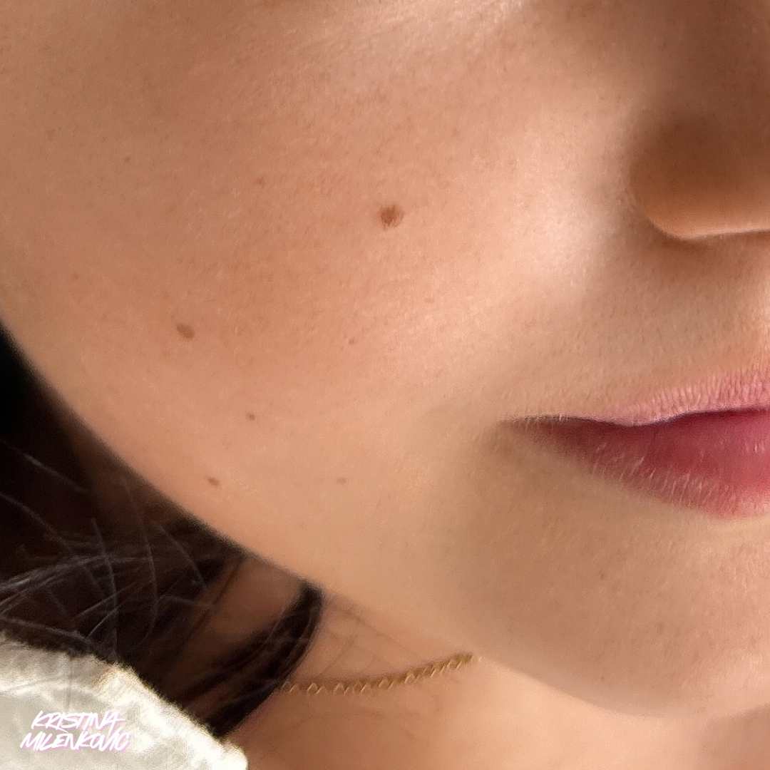 Ein Schönheitsfleck und eine Muttermal Pigmetierung verleiht dem Gesicht ein gewisses Extra. Jetzt beratn lassen im Permanent Make Up Studio in Köln.
