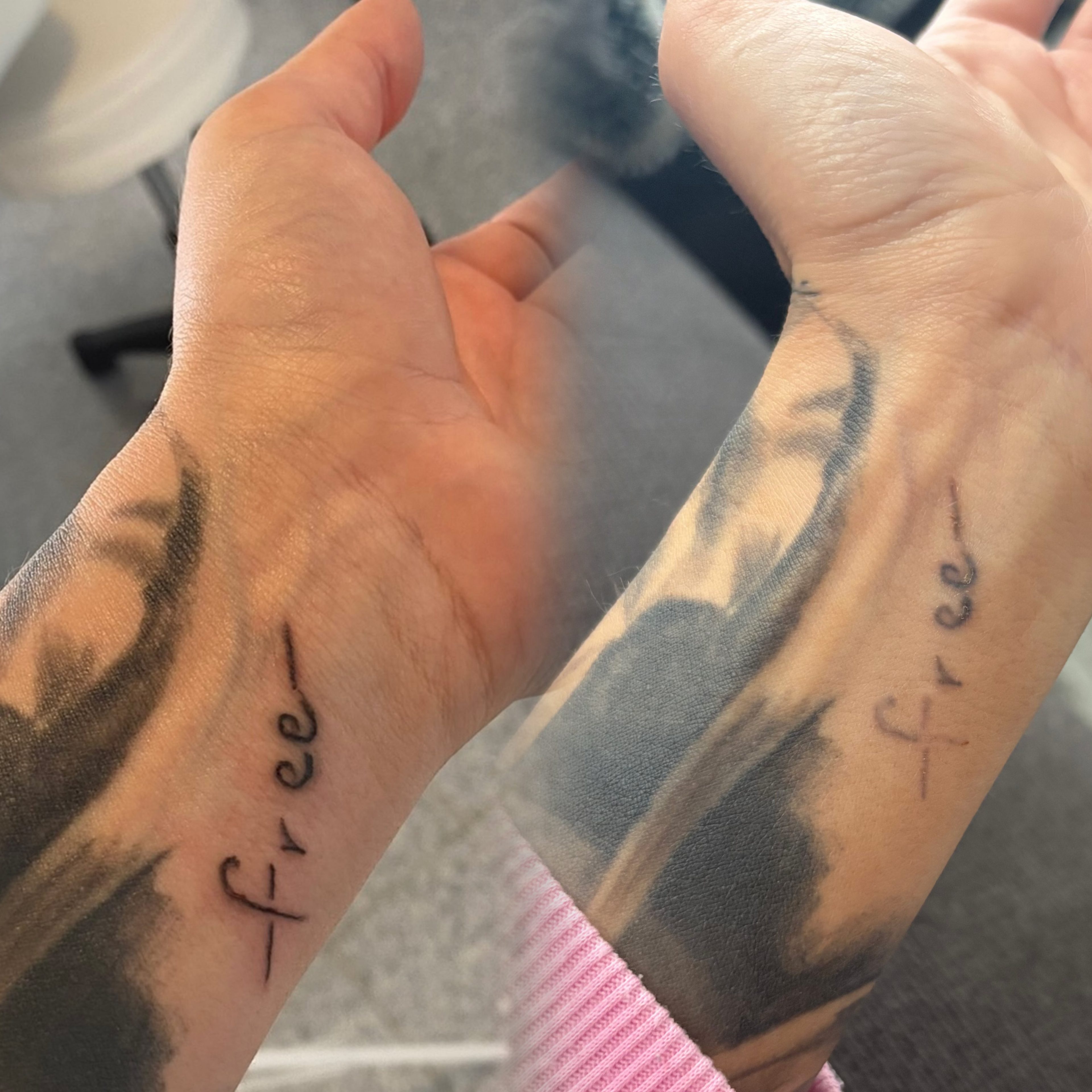 Ein Vorher Nachher Bild einer Remover Behnadlung an einem Tattoo